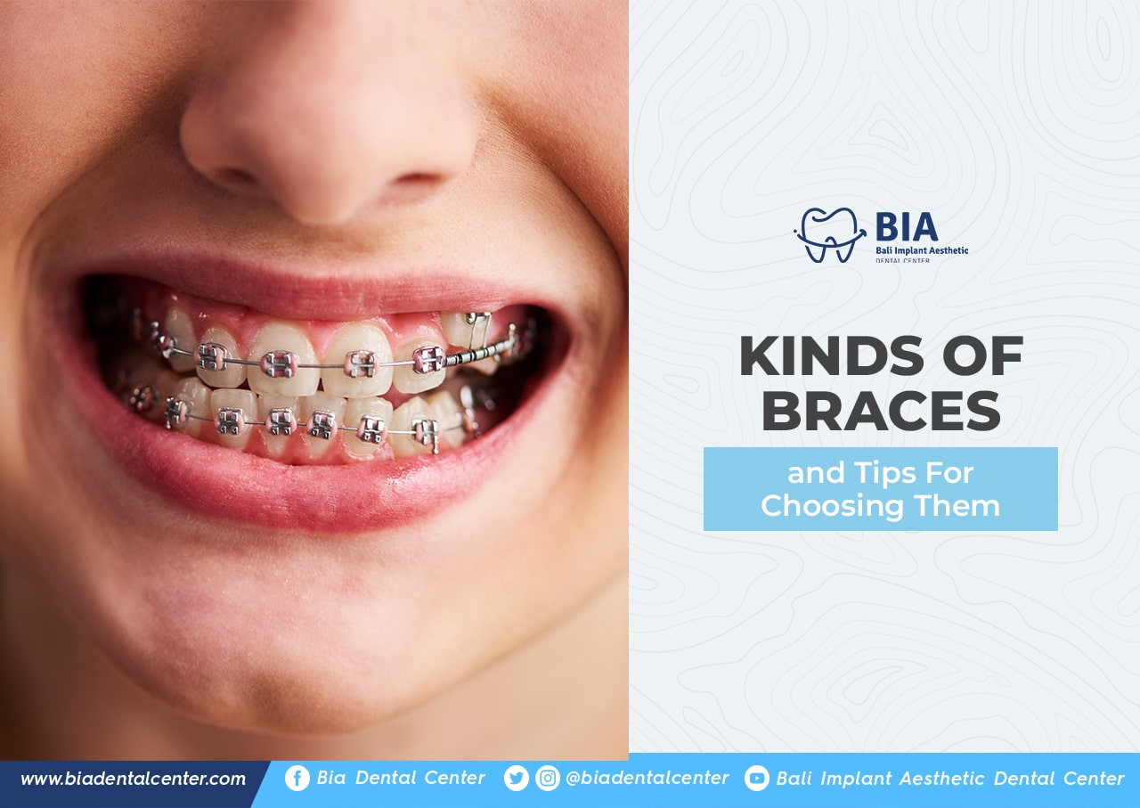 Blog Article Bia Dental