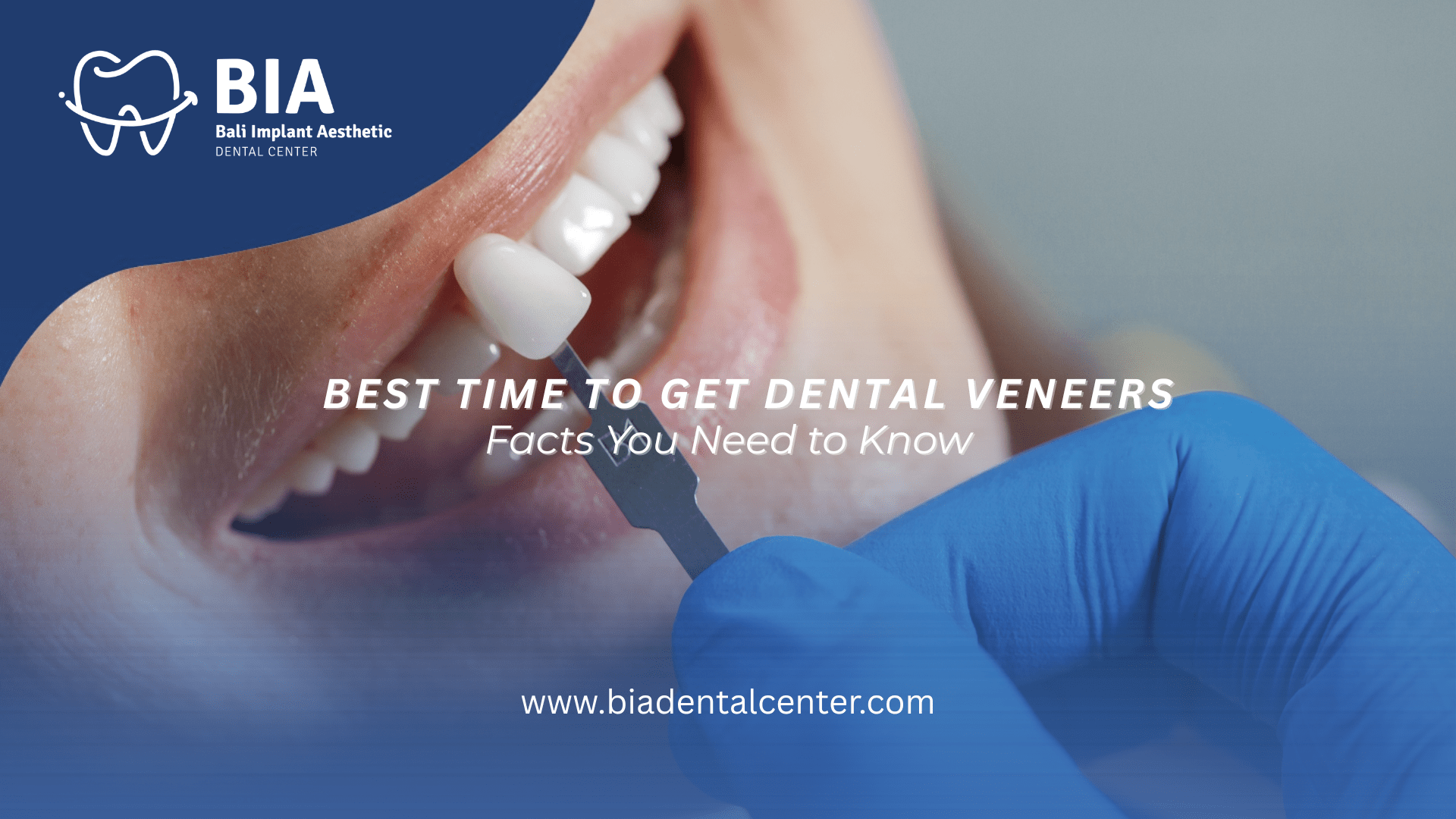 Blog Article Bia Dental