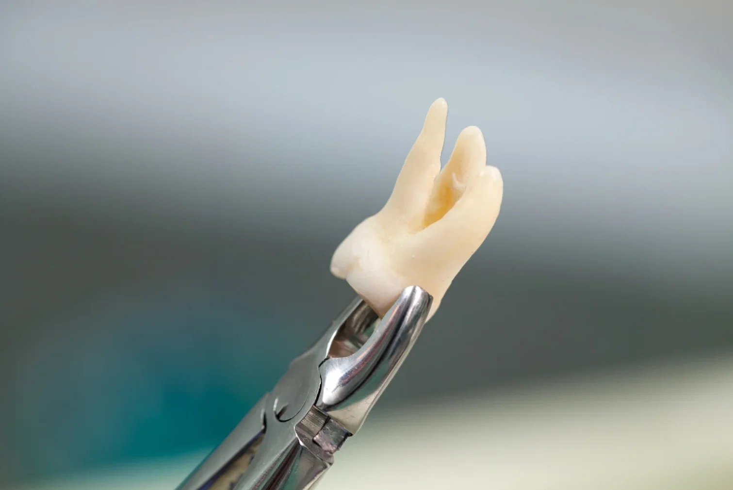 Treatment Bia Dental