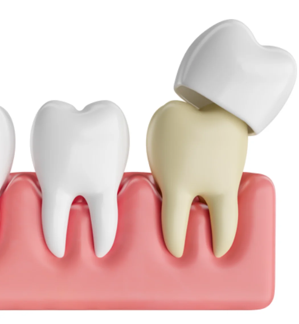Crown Bia Dental