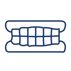 <p>Those who want to avoid removable dentures or grinding neighboring teeth (as with bridges)</p>