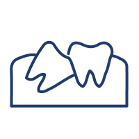 <p>Those with gaps, minor misalignment, or uneven tooth size/shape</p>